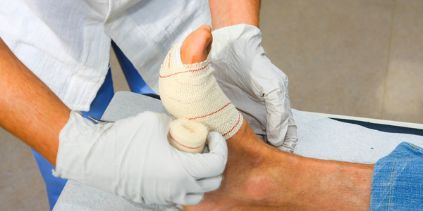 Foot Wound