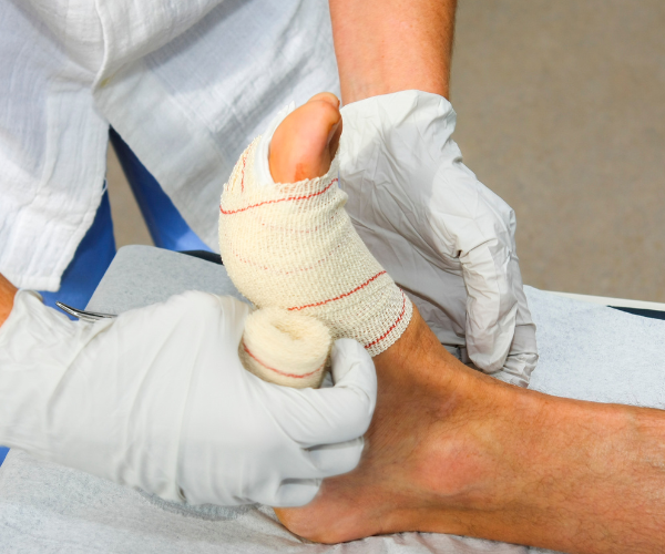 Wound Care